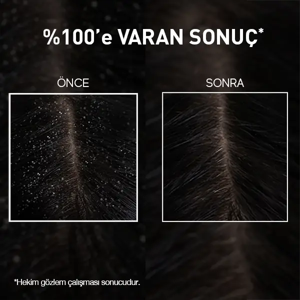 bioxcin kepek şampuanı