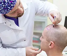 Saç Ekimi Saçın Hangi Aşamasında Yapılır?