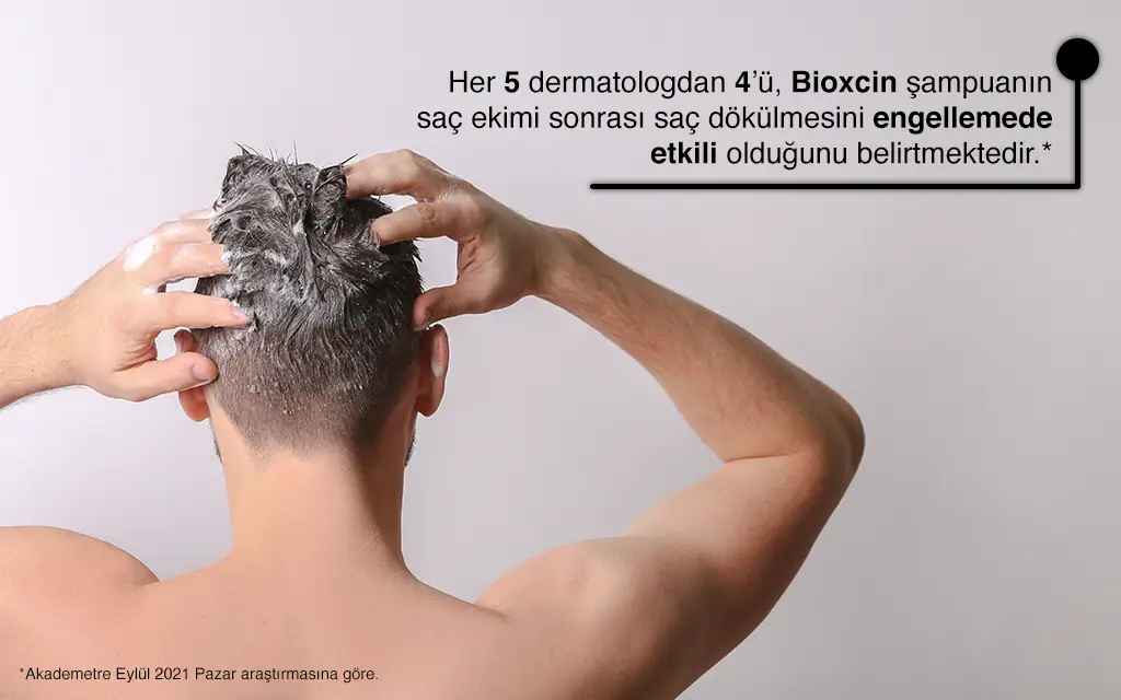 Saç Ekimi Sonrası Yapılmaması Gereken 7 Şey!