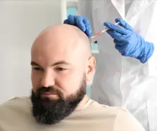 Saç Ekiminde Tepe Bölgesinde Başarı Oranı Ne Kadardır?