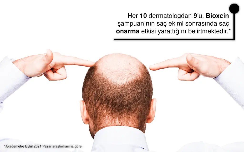 Saç Ekiminden Önce Yapmanız Gerekenler