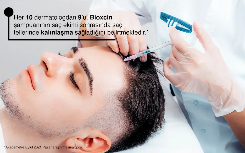 Saç Ekiminden Sonraki İlk 1 Ay Nasıl Geçer?