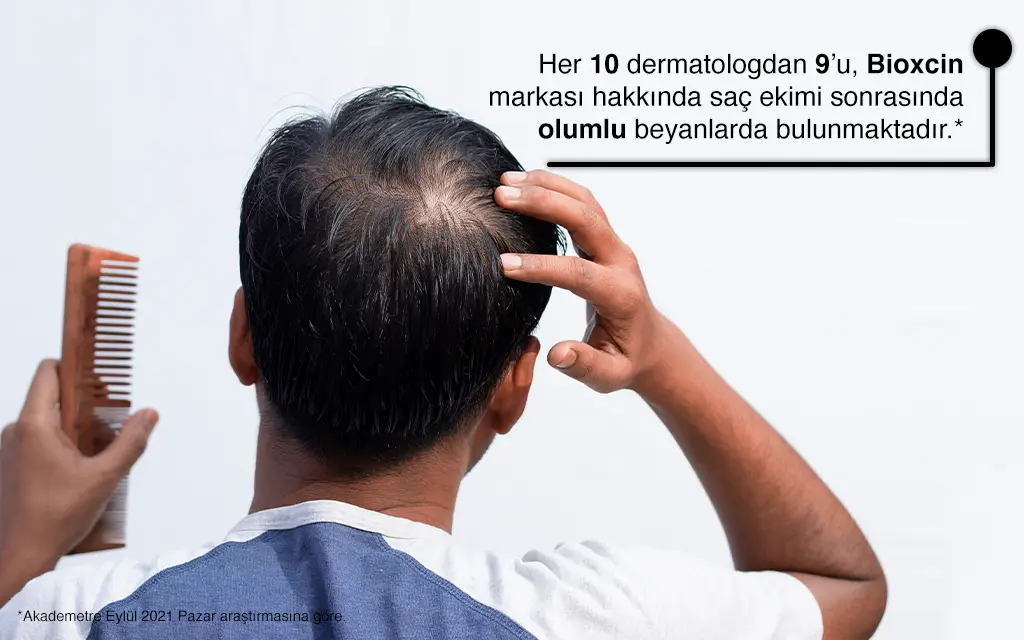 Saç Ekiminden Sonraki Süreci Kolaylaştıracak 5 Öneri