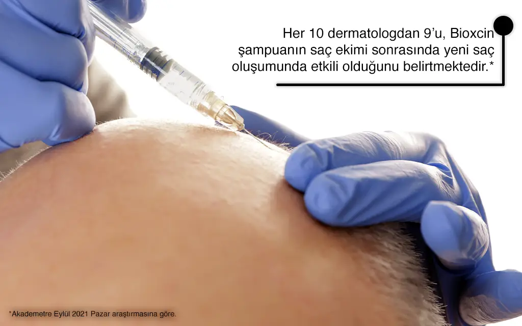 Saç Ektirmenin Yan Etkileri Var mıdır?