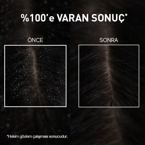 bioxcin yoğun kepek karşıtı ds şampuan